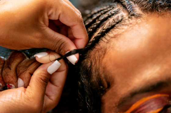 how to get rid of painful bumps caused from braids