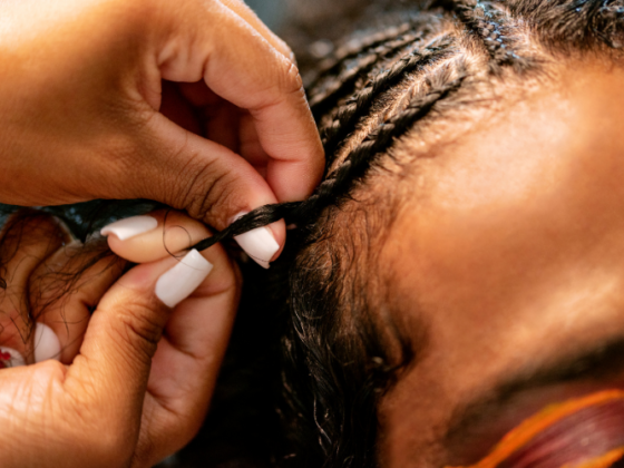 how to get rid of painful bumps caused from braids